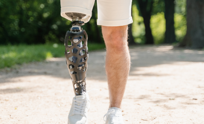 prosthetic-limbs-and-devices-pain