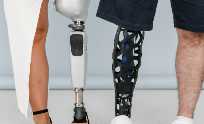 does-insurance-cover-prosthetics
