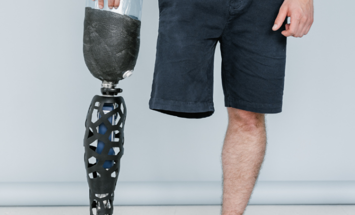 prosthetic-leg-socket