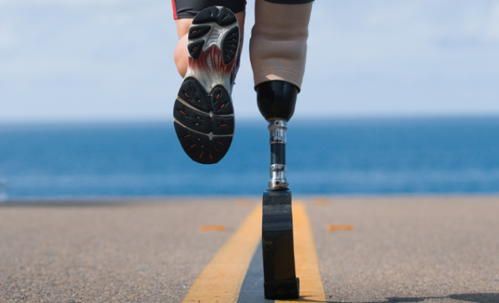 benefits-of-custom-prosthetic-sockets