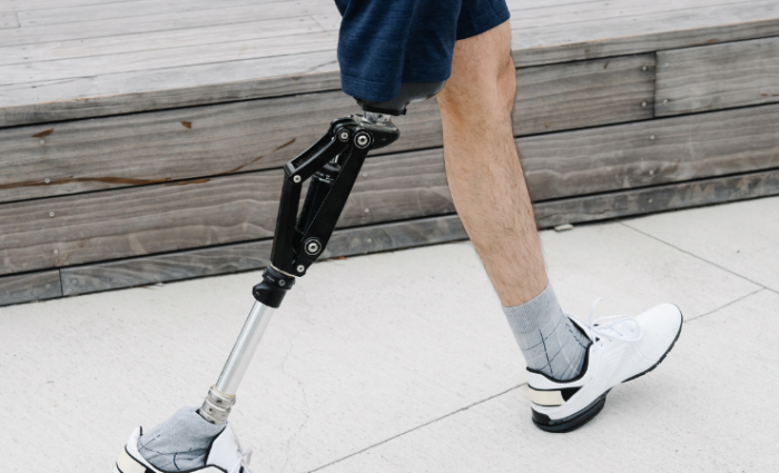 Experience the Quality of 34 Years in Prosthetic Technology with Grace Prosthetic Fabrication