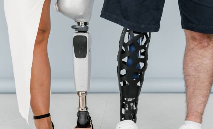 Advances in Prosthetic Technology: What Medical Professionals Need to Know