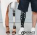 Advances in Prosthetic Technology: What Medical Professionals Need to Know