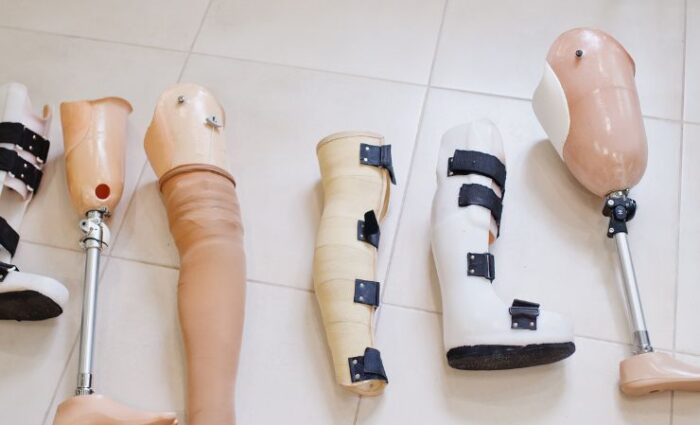 Pediatric Prosthetics: Special Considerations for Young Patients