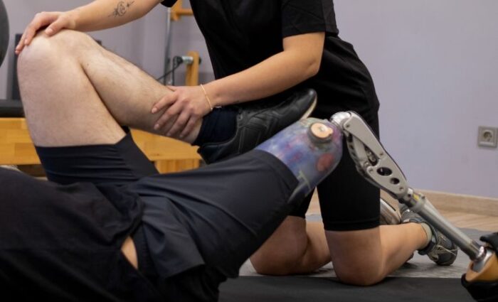 The Role of Physical Therapy in Prosthetic Rehabilitation