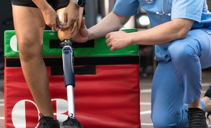 Integrating Physical Therapy with Prosthetic Rehabilitation for Optimal Outcomes