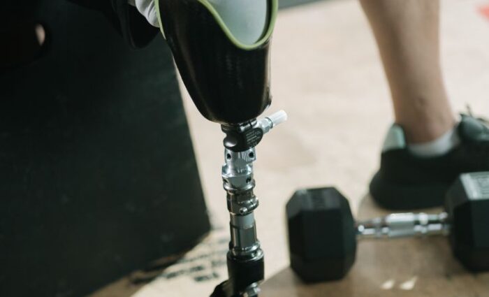 A patient using a custom prosthetic