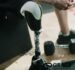 How Custom Prosthetics Improve Patient Outcomes