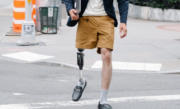 A patient running with a high-quality prosthetic