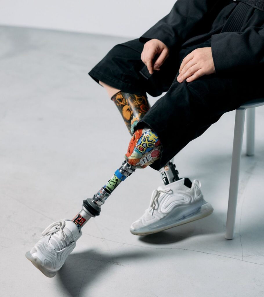 Below Knee Prosthetic Legs